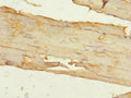 Immunohistochemistry of paraffin-embedded human skeletal muscle tissue using CSB-PA891732ESR1HU at dilution of 1:100