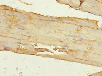 Immunohistochemistry of paraffin-embedded human skeletal muscle tissue using CSB-PA891732ESR1HU at dilution of 1:100