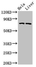 Western Blot
Positive WB detected in: Hela whole cell lysate, Rat liver tissue
All lanes: ACSL5 antibody at 3µg/ml
Secondary
Goat polyclonal to rabbit IgG at 1/50000 dilution
Predicted band size: 76, 83, 74, kDa
Observed band size: 76 kDa