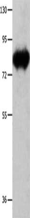 Gel: 8%SDS-PAGE, Lysate: 30 ug, Lane: Mouse heart tissue, Primary antibody: CSB-PA891748(ECE1 Antibody) at dilution 1/900, Secondary antibody: Goat anti rabbit IgG at 1/8000 dilution, Exposure time: 10 seconds