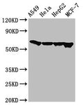 Western Blot
Positive WB detected in: A549 whole cell lysate, Hela whole cell lysate, HepG2 whole cell lysate, MCF-7 whole cell lysate
All lanes: FZD10 antibody at 3ug/ml
Secondary
Goat polyclonal to rabbit IgG at 1/50000 dilution
Predicted band size: 66 kDa
Observed band size: 66 kDa