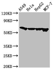 Western Blot
Positive WB detected in: A549 whole cell lysate, Hela whole cell lysate, HepG2 whole cell lysate, MCF-7 whole cell lysate
All lanes: FZD10 antibody at 3ug/ml
Secondary
Goat polyclonal to rabbit IgG at 1/50000 dilution
Predicted band size: 66 kDa
Observed band size: 66 kDa