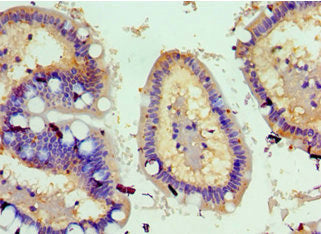 Immunohistochemistry of paraffin-embedded human small intestine tissue using CSB-PA891791ESR1HU at dilution of 1:100