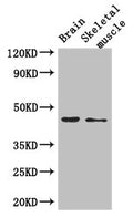 Western Blot
Positive WB detected in: Mouse brain tissue, Mouse skeletal muscle tissue
All lanes: AJAP1 antibody at 2.7ug/ml
Secondary
Goat polyclonal to rabbit IgG at 1/50000 dilution
Predicted band size: 45 kDa
Observed band size: 45 kDa