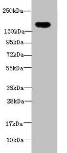 Western blot
All lanes: ADAMTS7 antibody at 2ug/ml + Mouse brain tissue
Secondary
Goat polyclonal to rabbit IgG at 1/10000 dilution
Predicted band size: 184 kDa
Observed band size: 184 kDa