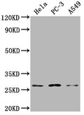 Western Blot
Positive WB detected in: Hela whole cell lysate, PC-3 whole cell lysate, A549 whole cell lysate
All lanes: RAB23 antibody at 1:2000
Secondary
Goat polyclonal to rabbit IgG at 1/50000 dilution
Predicted band size: 27 kDa
Observed band size: 27 kDa