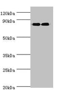 Western blot
All lanes: ANAPC5 antibody at 2ug/ml
Lane 1: 293T whole cell lysate
Lane 2: NIH/3T3 whole cell lysate
Secondary
Goat polyclonal to rabbit IgG at 1/10000 dilution
Predicted band size: 86, 26, 73 kDa
Observed band size: 86 kDa