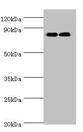 Western blot
All lanes: ANAPC5 antibody at 2ug/ml
Lane 1: 293T whole cell lysate
Lane 2: NIH/3T3 whole cell lysate
Secondary
Goat polyclonal to rabbit IgG at 1/10000 dilution
Predicted band size: 86, 26, 73 kDa
Observed band size: 86 kDa