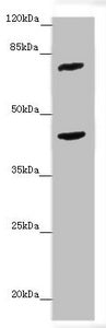 Western blot All lanes: ACSL6 antibody at 4.25 ug/ml + Mouse liver tissue Secondary Goat polyclonal to rabbit IgG at 1/10000 dilution Predicted band size: 78, 81, 75, 77, 80, 70 kDa Observed band size: 78, 42 kDa