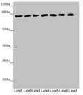 Western blot All lanes: ACSL6 antibody at 4.64µg/ml Lane 1: Mouse liver tissue Lane 2: Mouse heart tissue Lane 3: Mouse brain tissue Lane 4: Mouse gonadal tissue Lane 5: Jurkat whole cell lysate Lane 6: Raji whole cell lysate Lane 7: K562 whole cell lysate Secondary Goat polyclonal to rabbit IgG at 1/10000 dilution Predicted band size: 78, 81, 75, 77, 80, 70 kDa Observed band size: 78 kDa