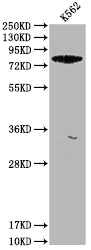 Western Blot
Positive WB detected in: K562 whole cell lysate
All lanes: ACSL6 antibody at 1:1000
Secondary
Goat polyclonal to rabbit IgG at 1/50000 dilution
Predicted band size: 78, 81, 75, 77, 80, 70 kDa
Observed band size: 78 kDa