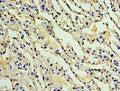 Immunohistochemistry of paraffin-embedded human lung tissue using CSB-PA892152ESR1HU at dilution of 1:100