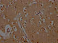 IHC image of CSB-PA892176HA01HU diluted at 1:200 and staining in paraffin-embedded human brain tissue performed on a Leica BondTM system. After dewaxing and hydration, antigen retrieval was mediated by high pressure in a citrate buffer (pH 6.0). Section was blocked with 10% normal goat serum 30min at RT. Then primary antibody (1% BSA) was incubated at 4°C overnight. The primary is detected by a Goat anti-rabbit polymer IgG labeled by HRP and visualized using 0.05% DAB.