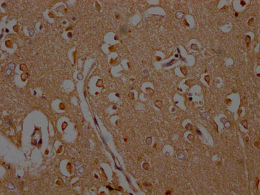 IHC image of CSB-PA892176HA01HU diluted at 1:200 and staining in paraffin-embedded human brain tissue performed on a Leica BondTM system. After dewaxing and hydration, antigen retrieval was mediated by high pressure in a citrate buffer (pH 6.0). Section was blocked with 10% normal goat serum 30min at RT. Then primary antibody (1% BSA) was incubated at 4°C overnight. The primary is detected by a Goat anti-rabbit polymer IgG labeled by HRP and visualized using 0.05% DAB.