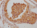 IHC image of CSB-PA892327LA01HU diluted at 1:200 and staining in paraffin-embedded human testis tissue performed on a Leica BondTM system. After dewaxing and hydration, antigen retrieval was mediated by high pressure in a citrate buffer (pH 6.0). Section was blocked with 10% normal goat serum 30min at RT. Then primary antibody (1% BSA) was incubated at 4°C overnight. The primary is detected by a Goat anti-rabbit polymer IgG labeled by HRP and visualized using 0.05% DAB.