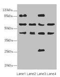 Western blot All lanes: FLVCR2 antibody at 0.89ug/ml Lane 1: MCF-7 whole cell lysate Lane 2: A549 whole cell lysate Lane 3: Mouse lung tissue Lane 4: Mouse liver tissue Secondary Goat polyclonal to rabbit IgG at 1/10000 dilution Predicted band size: 58, 36 kDa Observed band size: 58, 86, 45, 26 kDa