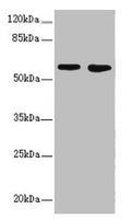 Western blot All lanes: FLVCR2 antibody at 0.83µg/ml Lane 1: A549 whole cell lysate Lane 2: Mouse lung tissue Secondary Goat polyclonal to rabbit IgG at 1/10000 dilution Predicted band size: 58, 36 kDa Observed band size: 58 kDa