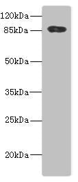 Western blot All lanes: ADAM28 antibody IgG at 5.6ug/ml + PC-3 whole cell lysate Secondary Goat polyclonal to rabbit IgG at 1/10000 dilution Predicted band size: 88, 62 kDa Observed band size: 88 kDa