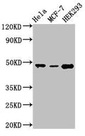 Western Blot
Positive WB detected in: Hela whole cell lysate, MCF-7 whole cell lysate, HEK293 whole cell lysate
All lanes: PACSIN3 antibody at 2.8µg/ml
Secondary
Goat polyclonal to rabbit IgG at 1/50000 dilution
Predicted band size: 49 kDa
Observed band size: 49 kDa