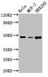 Western Blot
Positive WB detected in: Hela whole cell lysate, MCF-7 whole cell lysate, HEK293 whole cell lysate
All lanes: PACSIN3 antibody at 2.8µg/ml
Secondary
Goat polyclonal to rabbit IgG at 1/50000 dilution
Predicted band size: 49 kDa
Observed band size: 49 kDa