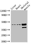 Western Blot
Positive WB detected in: Mouse liver tissue, Mouse heart tissue, Mouse skeletal muscle tissue
All lanes: ACAD8 antibody at 3ug/ml
Secondary
Goat polyclonal to rabbit IgG at 1/50000 dilution
Predicted band size: 46, 32, 39 kDa
Observed band size: 46, 39 kDa