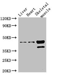 Western Blot
Positive WB detected in: Mouse liver tissue, Mouse heart tissue, Mouse skeletal muscle tissue
All lanes: ACAD8 antibody at 3ug/ml
Secondary
Goat polyclonal to rabbit IgG at 1/50000 dilution
Predicted band size: 46, 32, 39 kDa
Observed band size: 46, 39 kDa