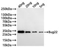 Western Blot
Positive WB detected in: recombinant protein
All lanes:Bug22 Antibody at 1:1000
Secondary
Goat polyclonal to rabbit IgG at 1/20000 dilution
Predicted band size: 30.2 kDa
Observed band size: 30 kDa