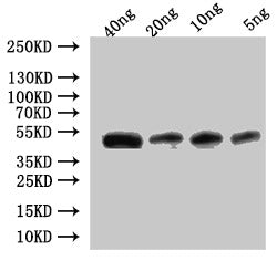 Western Blot
Positive WB detected in: recombinant protein
All lanes:Ctl2 Antibody at 1:1000
Secondary
Goat polyclonal to rabbit IgG at 1/50000 dilution
Predicted band size: 43.5 kDa
Observed band size: 45 kDa
