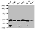 Western Blot
Positive WB detected in: K562 whole cell lysate,A549 whole cell lysate,293 whole cell lysate,U251 whole cell lysate,HL-60 whole cell lysate,Hela whole cell lysate
All lanes: VDAC3 antibody at 1:1000
Secondary
Goat polyclonal to rabbit IgG at 1/50000 dilution
Predicted band size: 31 kDa
Observed band size: 32 kDa