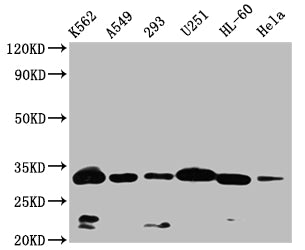 Western Blot
Positive WB detected in: K562 whole cell lysate,A549 whole cell lysate,293 whole cell lysate,U251 whole cell lysate,HL-60 whole cell lysate,Hela whole cell lysate
All lanes: VDAC3 antibody at 1:1000
Secondary
Goat polyclonal to rabbit IgG at 1/50000 dilution
Predicted band size: 31 kDa
Observed band size: 32 kDa