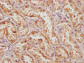 IHC image of CSB-PA896505HA01HU diluted at 1:100 and staining in paraffin-embedded human kidney tissue performed on a Leica BondTM system. After dewaxing and hydration, antigen retrieval was mediated by high pressure in a citrate buffer (pH 6.0). Section was blocked with 10% normal goat serum 30min at RT. Then primary antibody (1% BSA) was incubated at 4°C overnight. The primary is detected by a Goat anti-rabbit polymer IgG labeled by HRP and visualized using 0.05% DAB.