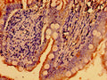 WNK2 Antibody – Figure 1 of 3