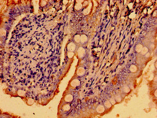 WNK2 Antibody – Figure 1 of 3