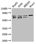 Western Blot
Positive WB detected in: HepG2 whole cell lysate, A549 whole cell lysate, HEK293 whole cell lysate, Mouse heart tissue
All lanes: HIF3A antibody at 2.5µg/ml
Secondary
Goat polyclonal to rabbit IgG at 1/50000 dilution
Predicted band size: 73, 69, 40, 67, 63, 65 kDa
Observed band size: 73, 69 kDa