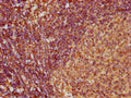 IHC image of CSB-PA896726LA01HU diluted at 1:100 and staining in paraffin-embedded human lymph node tissue performed on a Leica BondTM system. After dewaxing and hydration, antigen retrieval was mediated by high pressure in a citrate buffer (pH 6.0). Section was blocked with 10% normal goat serum 30min at RT. Then primary antibody (1% BSA) was incubated at 4°C overnight. The primary is detected by a biotinylated secondary antibody and visualized using an HRP conjugated SP system.