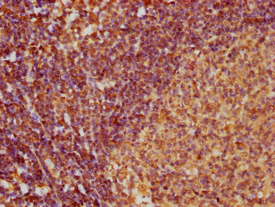 IHC image of CSB-PA896726LA01HU diluted at 1:100 and staining in paraffin-embedded human lymph node tissue performed on a Leica BondTM system. After dewaxing and hydration, antigen retrieval was mediated by high pressure in a citrate buffer (pH 6.0). Section was blocked with 10% normal goat serum 30min at RT. Then primary antibody (1% BSA) was incubated at 4°C overnight. The primary is detected by a biotinylated secondary antibody and visualized using an HRP conjugated SP system.