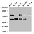 Western Blot
Positive WB detected in: A549 whole cell lysate, HL60 whole cell lysate, Hela whole cell lysate, SH-SY5Y whole cell lysate, Rat spleen tissue
All lanes: BACE2 antibody at 2.5ug/ml
Secondary
Goat polyclonal to rabbit IgG at 1/50000 dilution
Predicted band size: 57, 51, 43, 39, 47 kDa
Observed band size: 57, 43 kDa