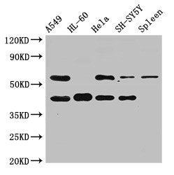 Western Blot
Positive WB detected in: A549 whole cell lysate, HL60 whole cell lysate, Hela whole cell lysate, SH-SY5Y whole cell lysate, Rat spleen tissue
All lanes: BACE2 antibody at 2.5ug/ml
Secondary
Goat polyclonal to rabbit IgG at 1/50000 dilution
Predicted band size: 57, 51, 43, 39, 47 kDa
Observed band size: 57, 43 kDa
