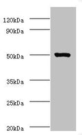 Western blot
All lanes: ACTL7A antibody at 2µg/ml + Mouse liver tissue
Secondary
Goat polyclonal to rabbit IgG at 1/10000 dilution
Predicted band size: 49 kDa
Observed band size: 49 kDa