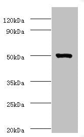 Western blot
All lanes: ACTL7A antibody at 2µg/ml + Mouse liver tissue
Secondary
Goat polyclonal to rabbit IgG at 1/10000 dilution
Predicted band size: 49 kDa
Observed band size: 49 kDa