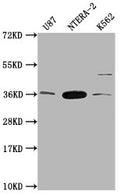 Western Blot
Positive WB detected in: U87 whole cell lysate, NTERA-2 whole cell lysate, K562 whole cell lysate
All lanes: CBY1 antibody at 1:2000
Secondary
Goat polyclonal to rabbit IgG at 1/50000 dilution
Predicted band size: 15 kDa
Observed band size: 35 kDa