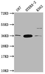 Western Blot
Positive WB detected in: U87 whole cell lysate, NTERA-2 whole cell lysate, K562 whole cell lysate
All lanes: CBY1 antibody at 1:2000
Secondary
Goat polyclonal to rabbit IgG at 1/50000 dilution
Predicted band size: 15 kDa
Observed band size: 35 kDa