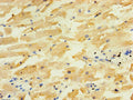 Immunohistochemistry of paraffin-embedded human heart tissue using CSB-PA896924LA01HU at dilution of 1:100