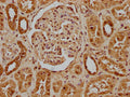 IHC image of CSB-PA896937LA01HU diluted at 1:100 and staining in paraffin-embedded human kidney tissue performed on a Leica BondTM system. After dewaxing and hydration, antigen retrieval was mediated by high pressure in a citrate buffer (pH 6.0). Section was blocked with 10% normal goat serum 30min at RT. Then primary antibody (1% BSA) was incubated at 4°C overnight. The primary is detected by a biotinylated secondary antibody and visualized using an HRP conjugated SP system.