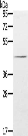 Gel: 8%SDS-PAGE, Lysate: 40 ug, Lane: Hela cells, Primary antibody: CSB-PA897216(FLI1 Antibody) at dilution 1/200, Secondary antibody: Goat anti rabbit IgG at 1/8000 dilution, Exposure time: 3 minutes