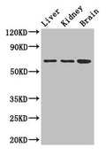 Western Blot
Positive WB detected in: Mouse liver tissue, Mouse kidney tissue, Mouse brain tissue
All lanes: AK5 antibody at 2.5ug/ml
Secondary
Goat polyclonal to rabbit IgG at 1/50000 dilution
Predicted band size: 64, 22, 61 kDa
Observed band size: 64 kDa