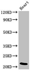 Western Blot
Positive WB detected in: Rat heart tissue
All lanes: NDUFB9 antibody at 4ug/ml
Secondary
Goat polyclonal to rabbit IgG at 1/50000 dilution
Predicted band size: 22 kDa
Observed band size: 22 kDa