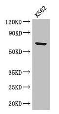 Western Blot
Positive WB detected in: K562 whole cell lysate
All lanes: BTRC antibody at 2.8µg/ml
Secondary
Goat polyclonal to rabbit IgG at 1/50000 dilution
Predicted band size: 69, 66 kDa
Observed band size: 69 kDa