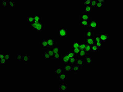 Immunofluorescence staining of PC-3 cells with CSB-PA897496LA01HU at 1:66, counter-stained with DAPI. The cells were fixed in 4% formaldehyde, permeabilized using 0.2% Triton X-100 and blocked in 10% normal Goat Serum. The cells were then incubated with the antibody overnight at 4&deg;C. The secondary antibody was Alexa Fluor 488-congugated AffiniPure Goat Anti-Rabbit IgG(H+L).