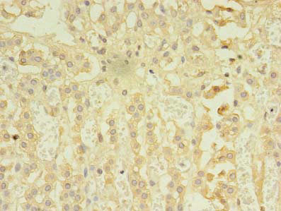 Immunohistochemistry of paraffin-embedded human adrenal gland tissue using CSB-PA897497LA01HU at dilution of 1:100